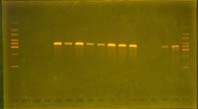 写真3　Nested　PCR検査結果の陽性例