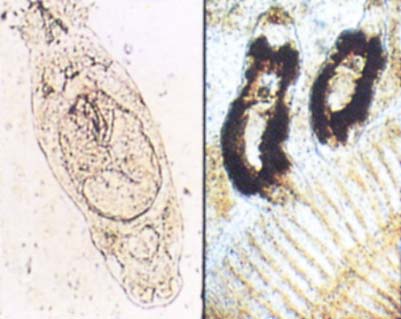 吸虫症の写真